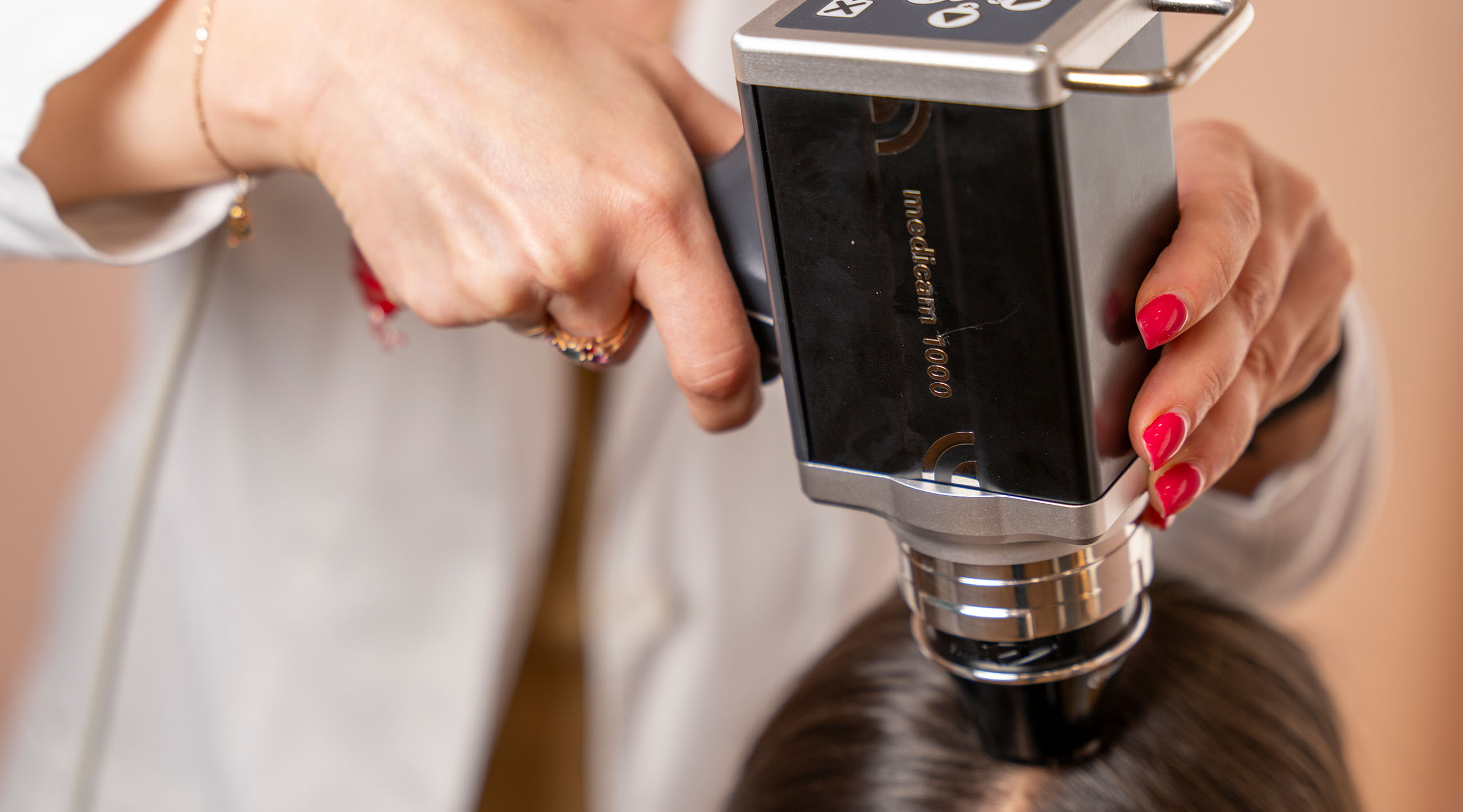 Trichoscopy scalp examination during a hair loss evaluation
