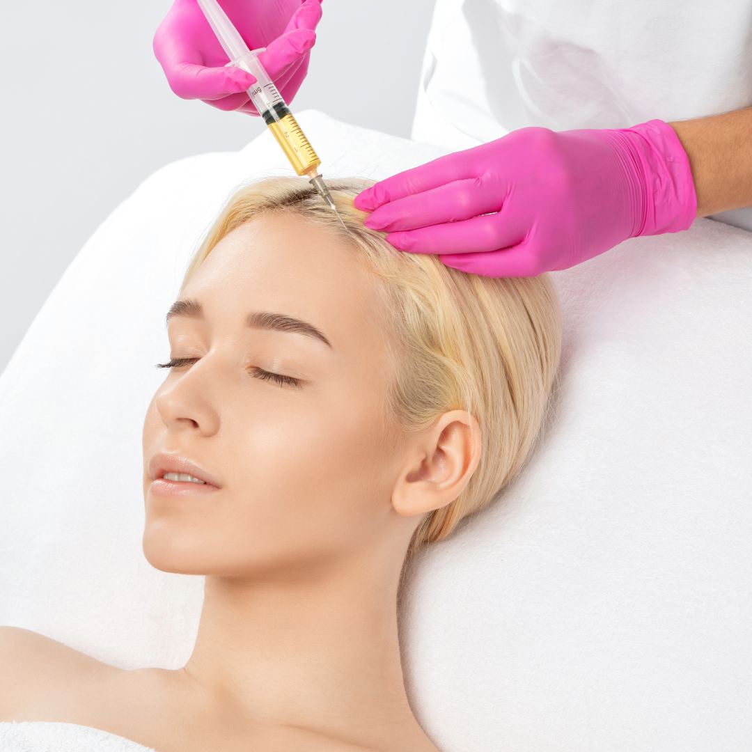 PRP scalp injections during hair restoration treatment