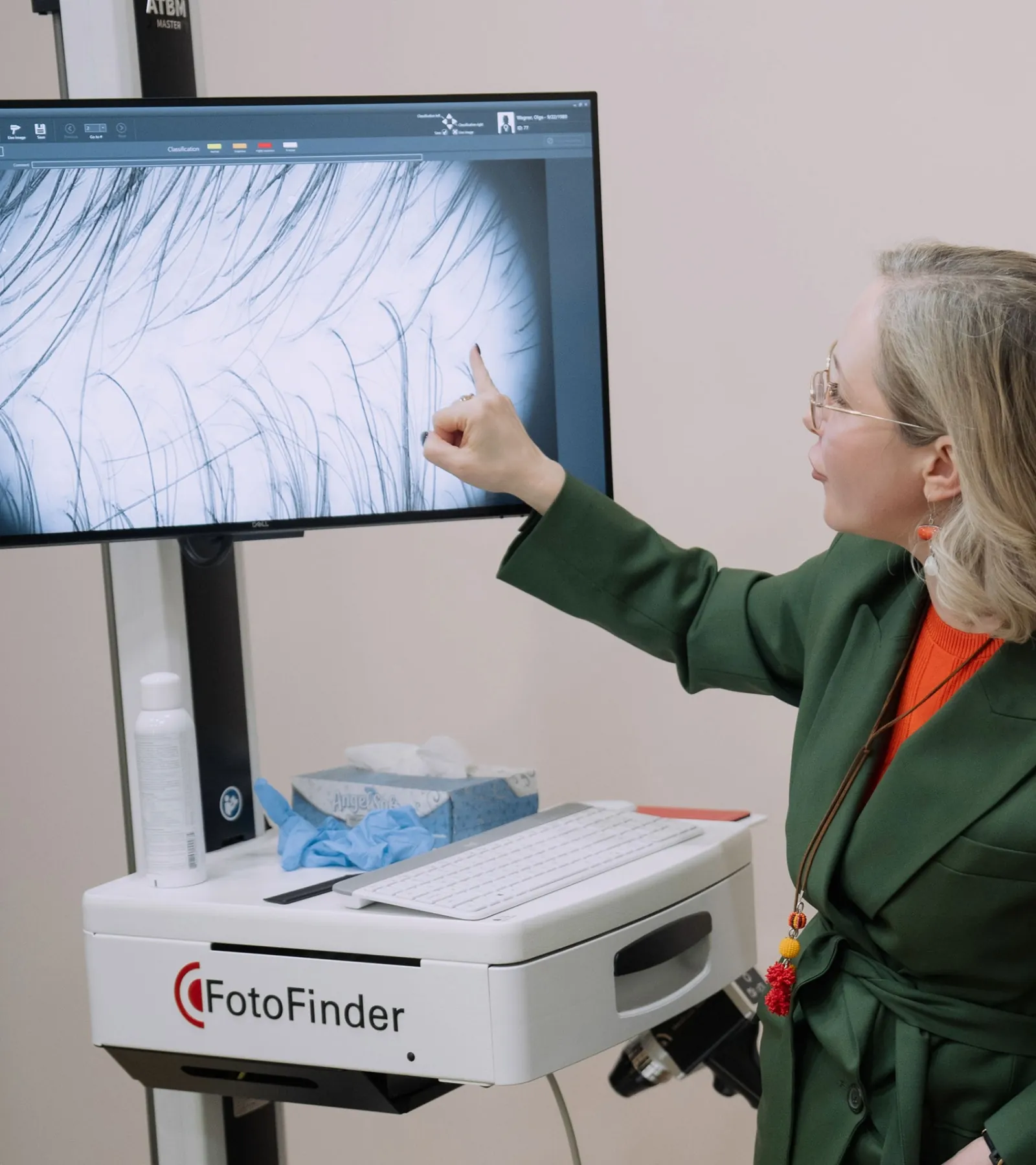 Dr. Viktoryia Kazlouskaya performing FotoFinder trichoscopy for hair transplant preparation in New York City