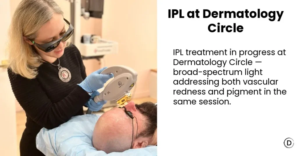 IPL treatment at Dermatology Circle in NYC for facial redness, rosacea and pigmentation.
