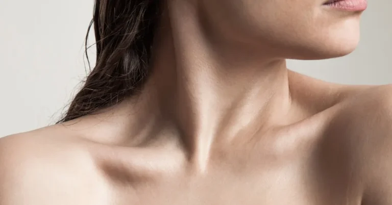 Close-up of the neck and décolletage illustrating skin quality and laxity concerns treated with cosmetic dermatology.