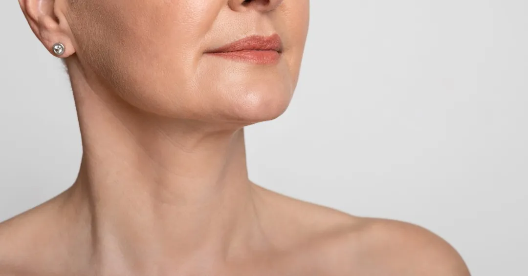 Close-up of mature neck and lower face showing skin laxity and age-related changes.